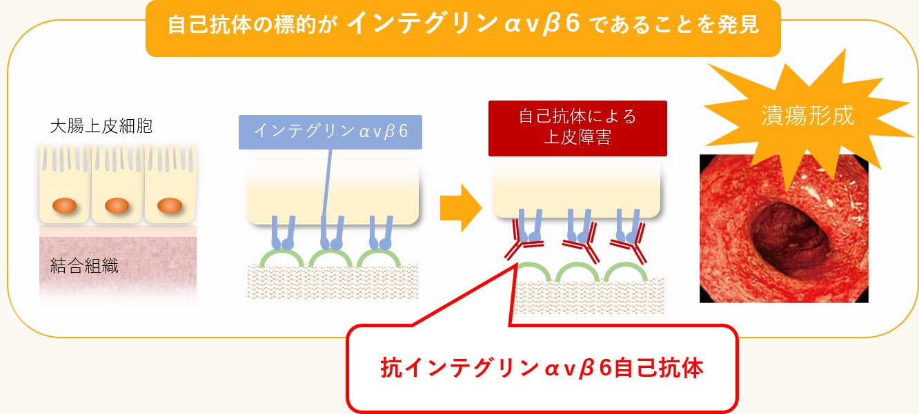 イメージ：京都大学医学部附属病院の挑戦